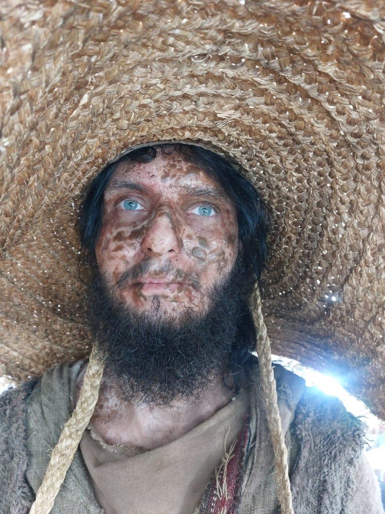 Prosthetic make-up on a leper character